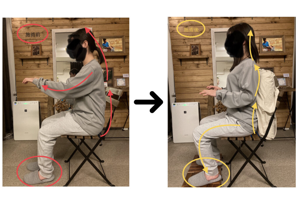 巻き肩、猫背、ストレートネック、五十肩、四十肩、姿勢改善